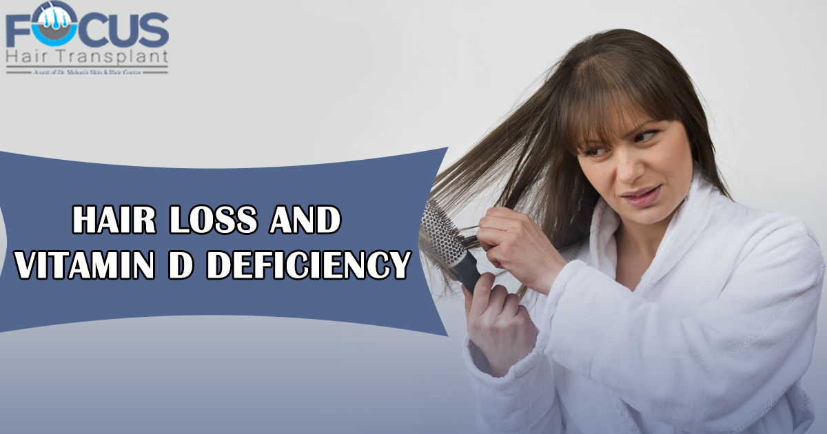 Hair-loss-And-Vitamin-D-Deficiency