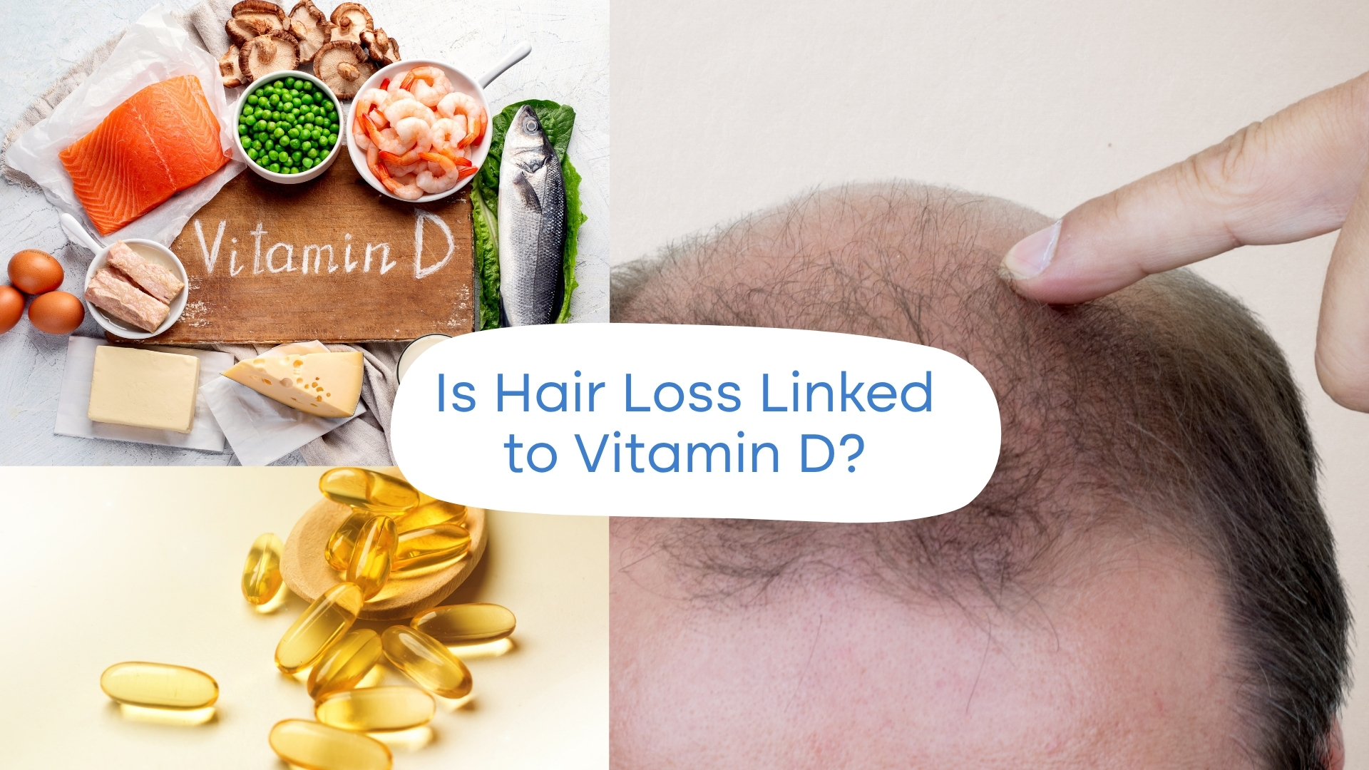 Vitamin-D-and-Hair-Loss_-What-the-Experts-Say-1