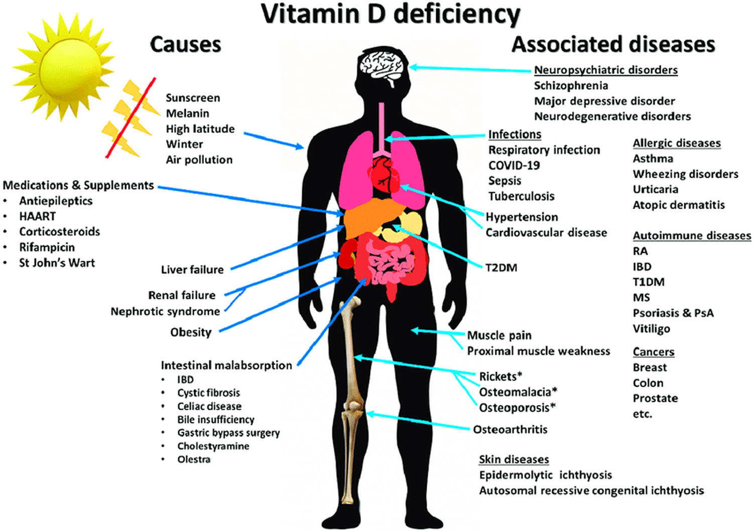 Vitamin-D-deficiency