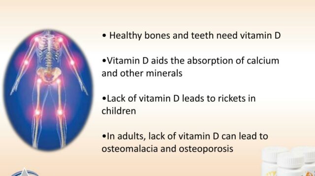 vitamin-d-and-bone-health-l